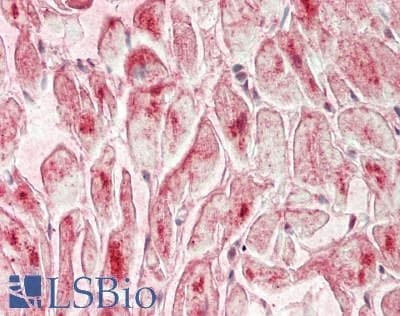IHC-plus™ Polyclonal Rabbit anti-Human NFKBIE / IKB Epsilon Antibody (Internal, IHC, IF, WB)