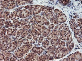 HDHD1 Antibody (clone OTI3E11)