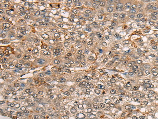 CDT1 Antibody
