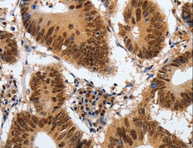 COPS5 / JAB1 Antibody