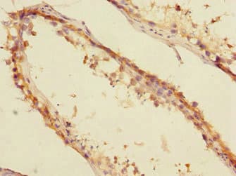 CBFA2T2 / MTGR1 Antibody