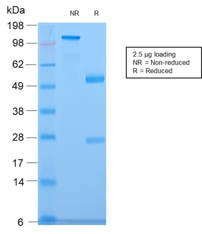 CELA3B / ELA3B Antibody (aa 82-238, clone CELA3B/2809R)