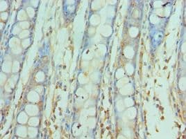 Polyclonal Rabbit anti-Human SNAP25 Antibody (aa1-206, IHC)