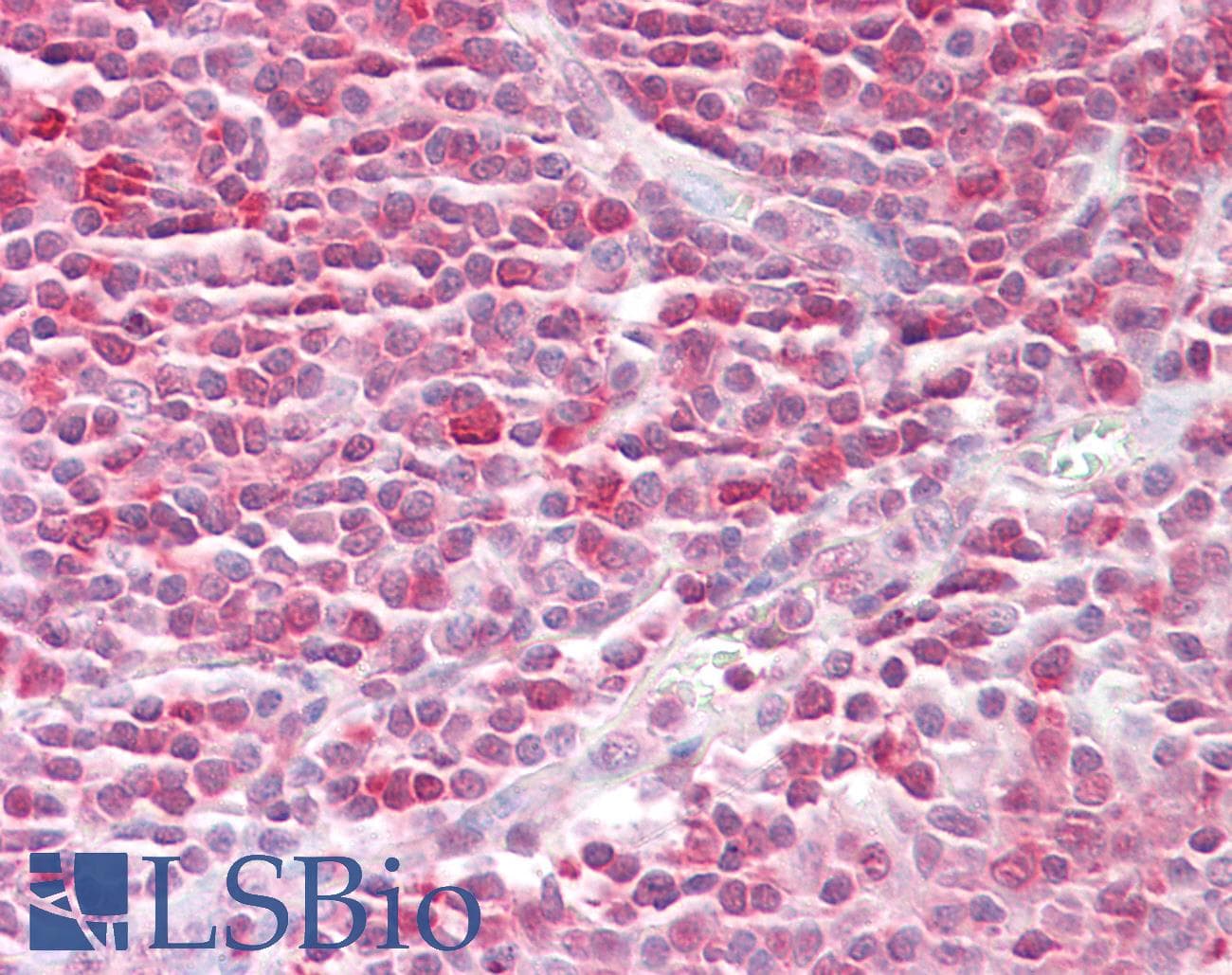 IHC-plus™ RAN Antibody (aa167-216)