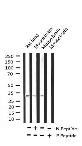 Polyclonal Rabbit anti-Human C/EBP Beta / CEBPB Antibody (phospho-Thr235,phospho-Thr188, IHC, IF, WB)