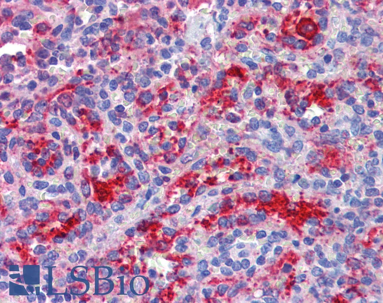 IHC-plus™ DDX58 / RIG-1 / RIG-I Antibody (C-Terminus)