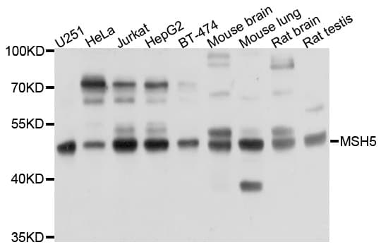 Polyclonal Rabbit anti-Human PRKAR1B Antibody (WB)
