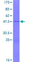 Human MRPL17 Protein (Recombinant GST)