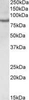 IHC-plus™ CRTC2 / TORC2 Antibody (aa83-96)