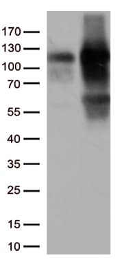Monoclonal Mouse anti-Human TRIM28 / KAP1 Antibody (clone OTI5E10, IHC, IF, WB)