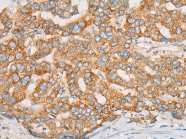 Polyclonal Rabbit anti-Human ATXN7 / SCA7 / Ataxin-7 Antibody (IHC)