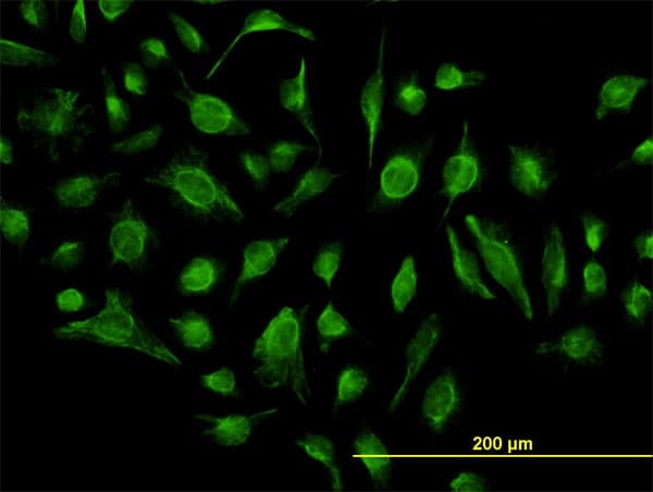 GABBR1 / GABA B Receptor 1 Antibody (clone 2D7)