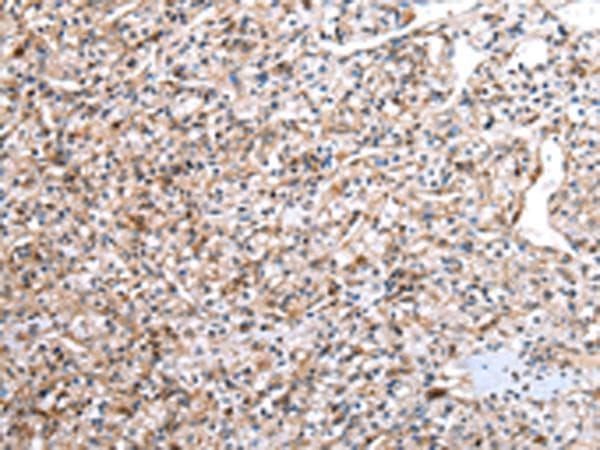 Polyclonal Rabbit anti-Human DCAF7 / WDR68 Antibody (IHC, WB)