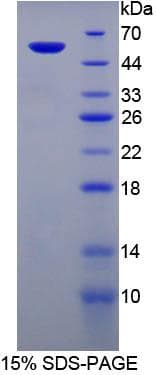 Mouse PGP Protein (Recombinant His-GST)