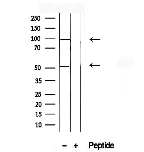 ACADVL Antibody