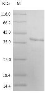 Human MARCH2 Protein (Recombinant 6His-SUMO, N-terminus)