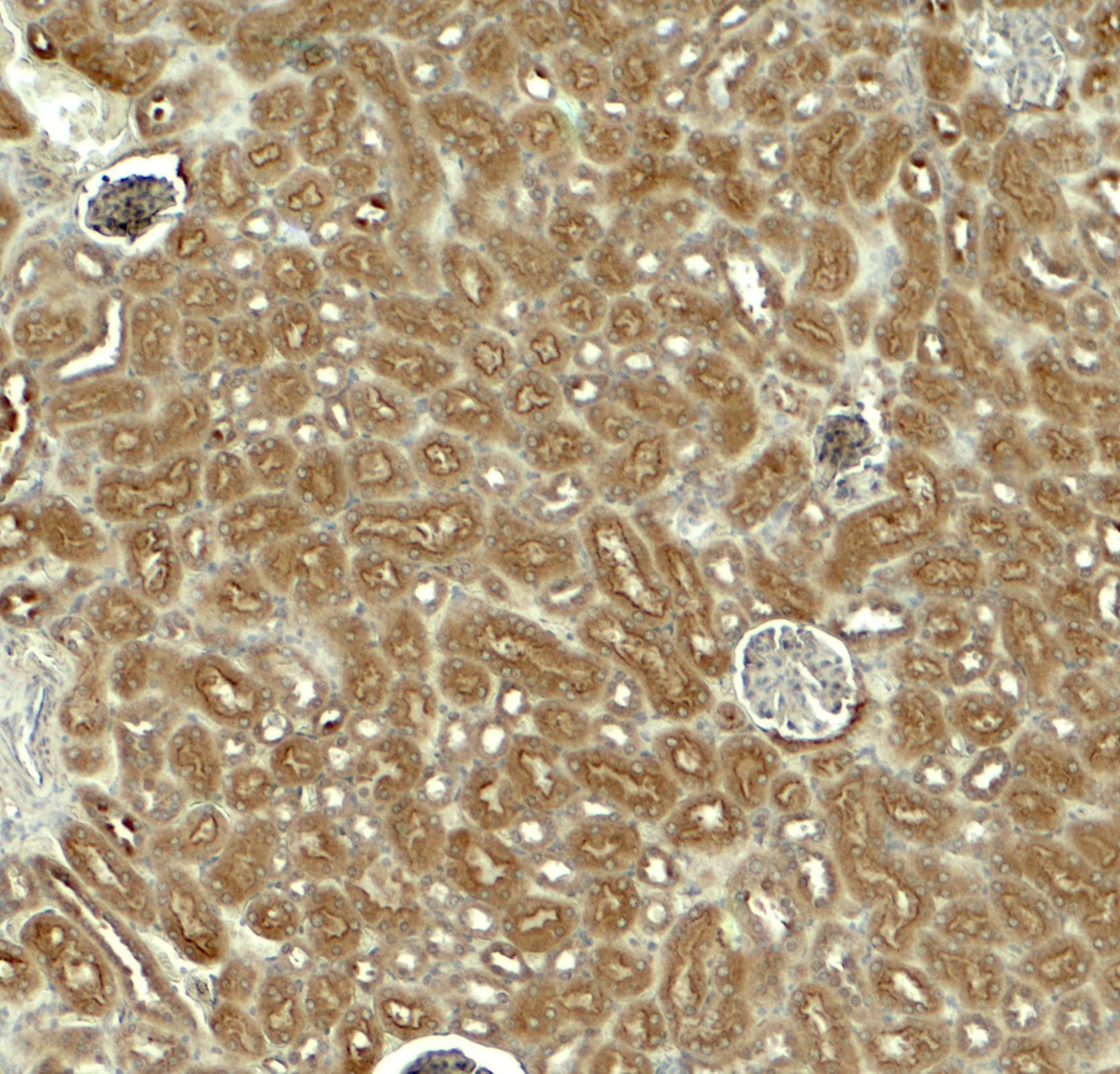 IHC-plus™ Polyclonal Rabbit anti-Human EDA / Ectodysplasin A Antibody (IHC, IF, WB)