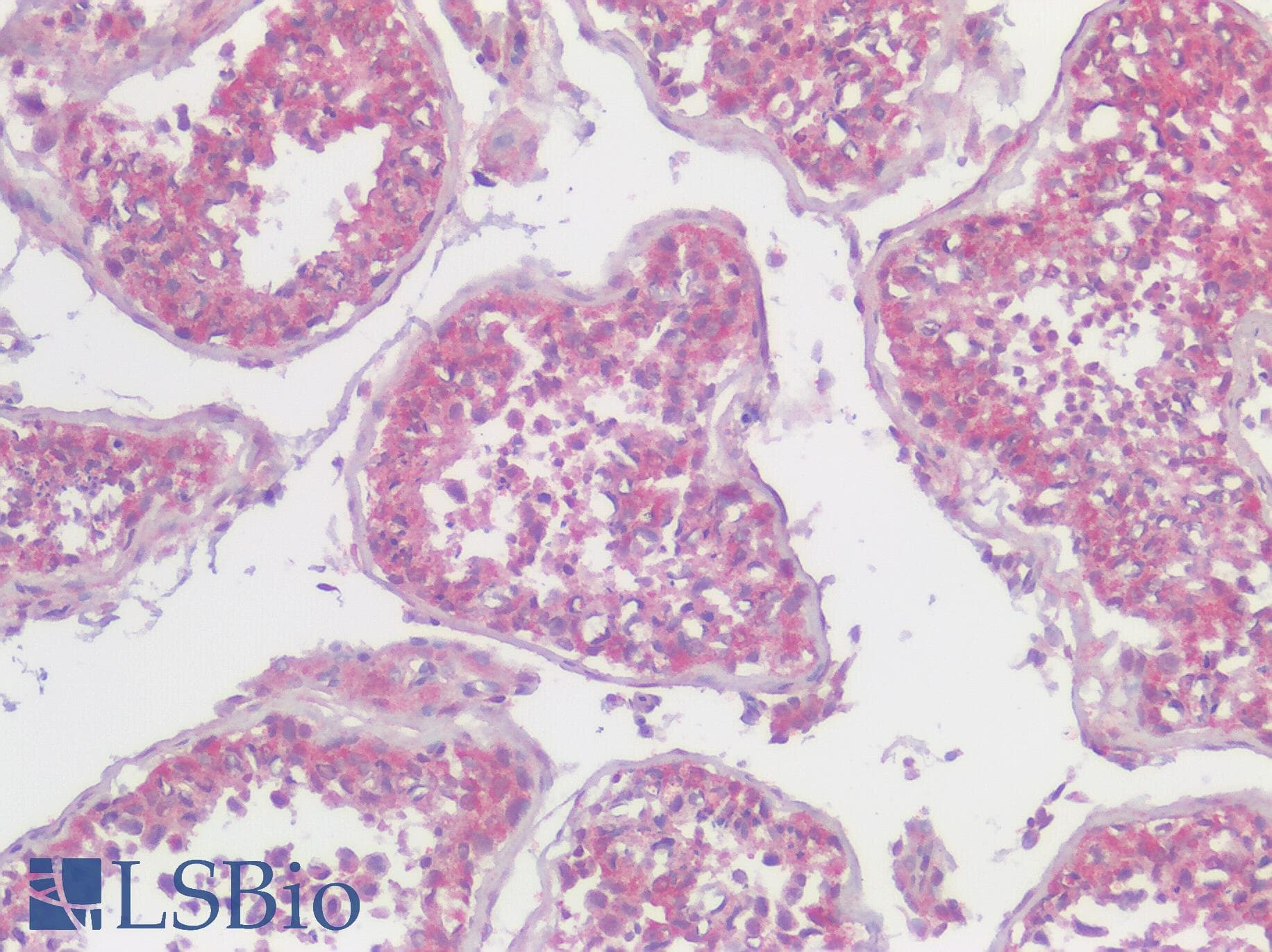 IHC-plus™ Polyclonal Rabbit anti-Human SLC29A1 / ENT1 Antibody (Internal, IHC)