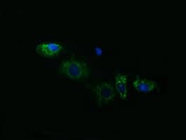 Monoclonal Mouse anti-Human ACAA2 Antibody (clone OTI2F6, IHC, IF, WB)