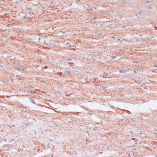 VASP Antibody