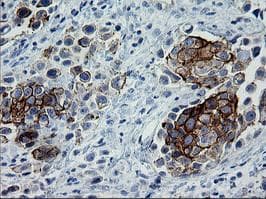 Monoclonal Mouse anti-Human ERBB2 / HER2 Antibody (clone OTI6F3, Carrier-free, aa676-1255, IHC, IF, WB)