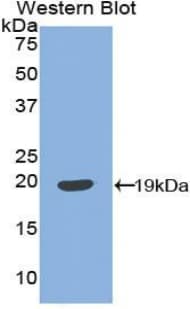 IGFBP3 Antibody (aa106-241)