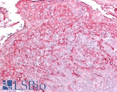Polyclonal Rabbit anti-Human FOXN1 Antibody (IHC, WB)