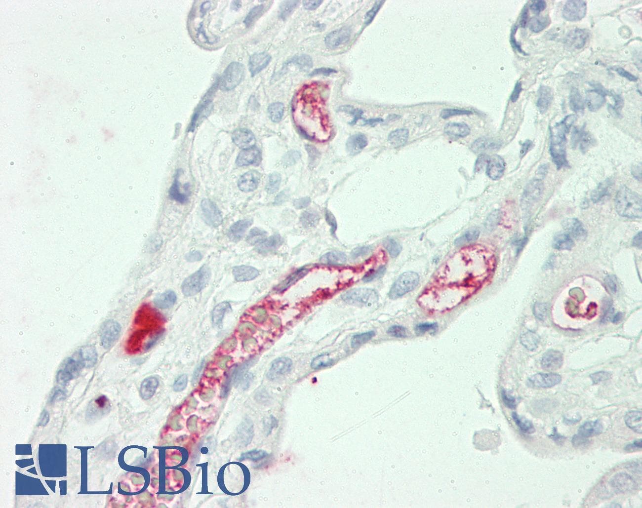 IHC-plus™ A2M / Alpha-2-Macroglobulin Antibody (aa417-430)