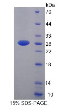 Human YAF2 Protein (Recombinant His-T7)