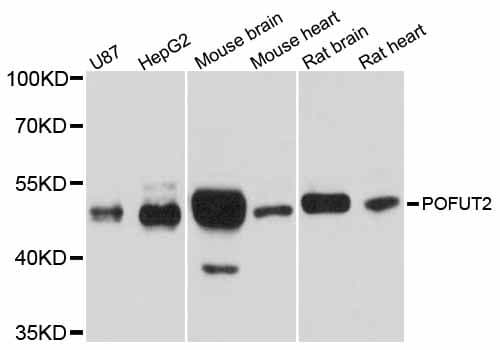 Polyclonal Rabbit anti-Human POFUT2 Antibody (WB)