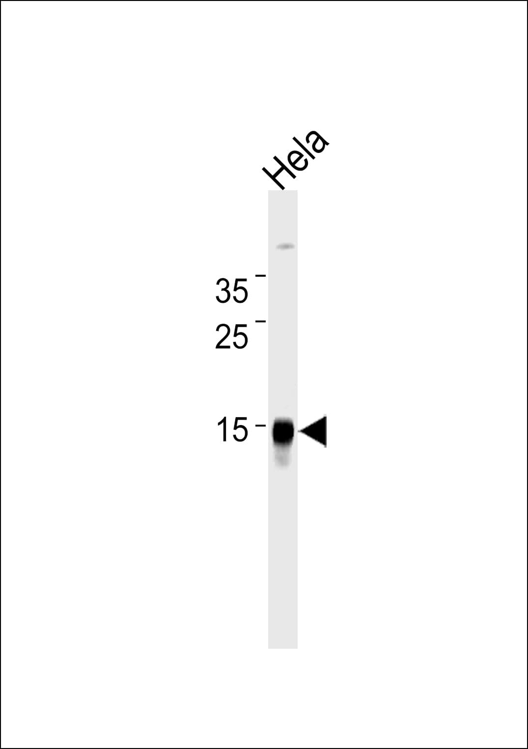 Monoclonal Mouse anti-Human CDA / Cytidine Deaminase Antibody (clone 921CT14.2.1, WB)