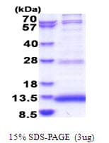 Human JTB / PAR Protein (Recombinant His)
