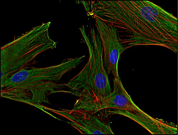CLTC / Clathrin Heavy Chain Antibody (clone BF-06)