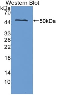 IFN Beta / Interferon Beta Antibody (aa22-186)
