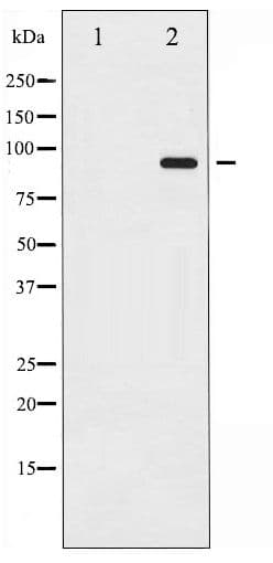 Polyclonal Rabbit anti-Human CTNNB1 / Beta Catenin Antibody (phospho-Thr41/Ser45, WB)