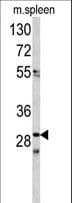 CDCA3 Antibody (aa41-69)