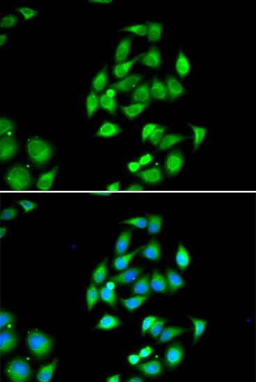Polyclonal Rabbit anti-Human NFS1 Antibody (IHC, IF, WB)