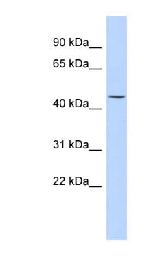 KRT24 / Keratin 24 Antibody (C-Terminus)