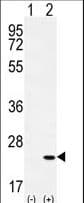 Polyclonal Rabbit anti-Human CRH / CRF Antibody (aa129-156, WB)