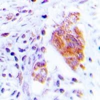Polyclonal Rabbit anti-Human CDC37 Antibody (N-Terminus, IHC, WB)