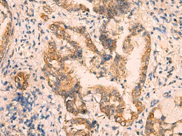CRYM Antibody