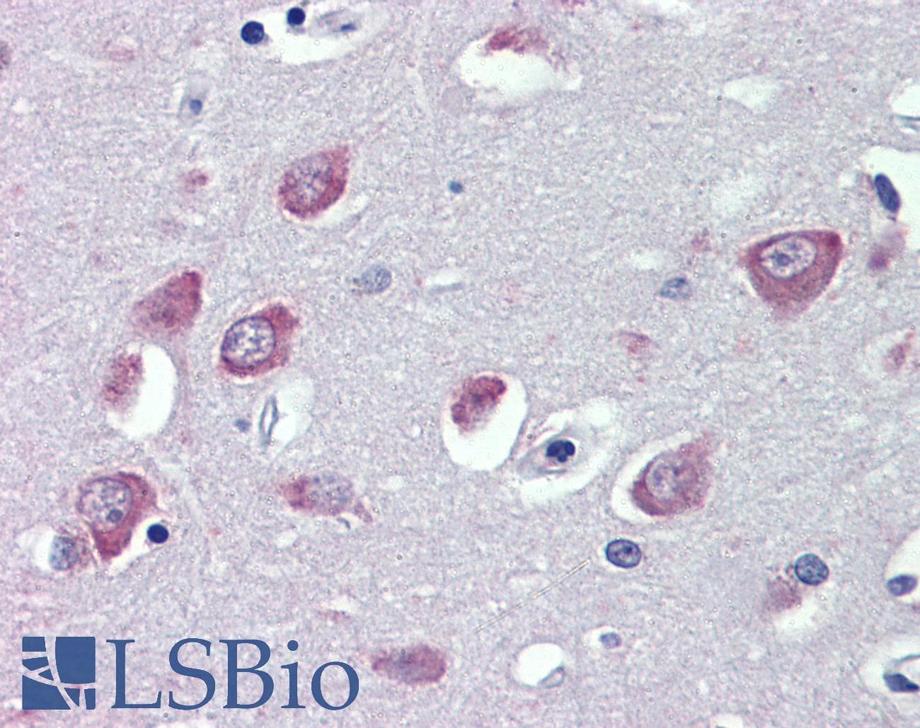 IHC-plus™ TRPC1 Antibody (aa722-733)