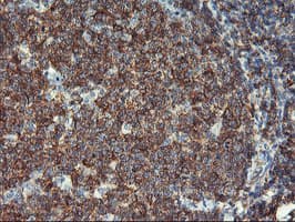 Monoclonal Mouse anti-Human VASP Antibody (clone OTI1F3, IHC, WB)