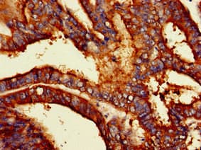 PODXL / Podocalyxin Antibody