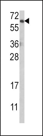 AKT1 Antibody (aa49-76)