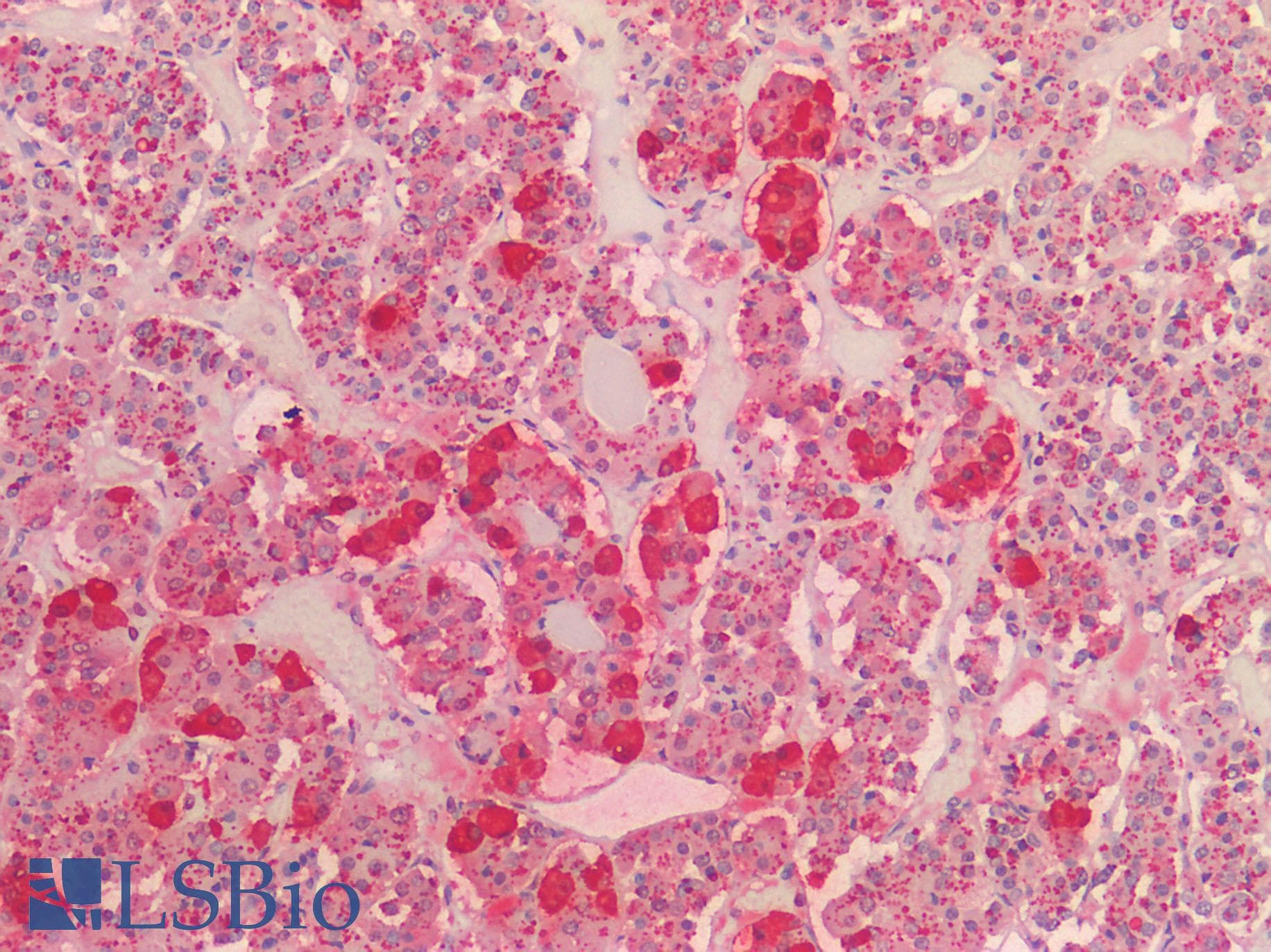 IHC-plus™ POMC / Proopiomelanocortin Antibody