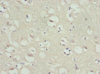 SAA1 / SAA / Serum Amyloid A Antibody