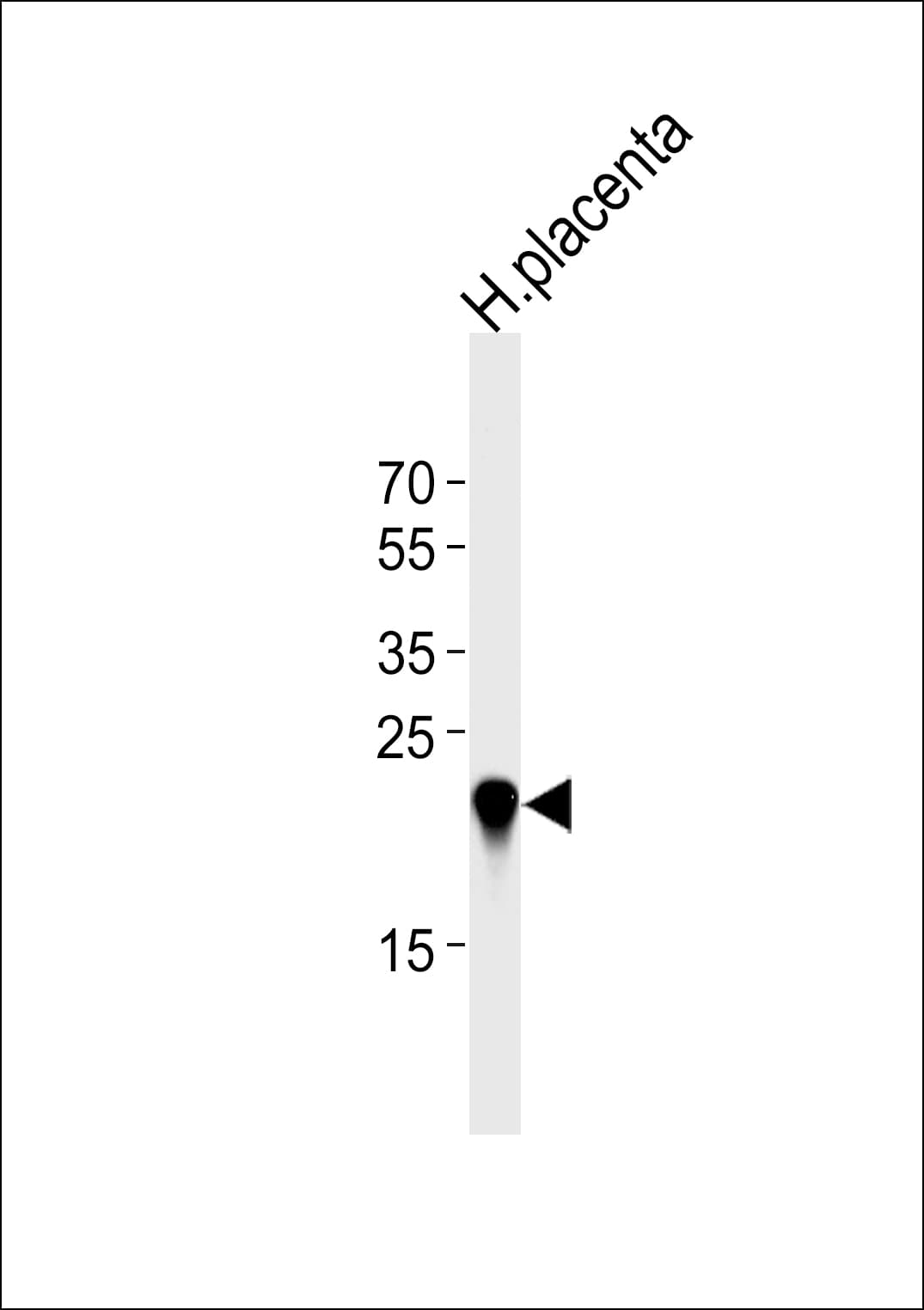 CSHL1 / CSH-Like 1 Antibody (aa156-185)