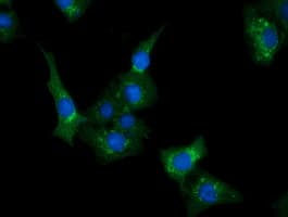 CLPP Antibody (clone OTI1D8)