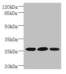 Polyclonal Rabbit anti-Mouse PLET1 / C11orf34 Antibody (IHC, WB)